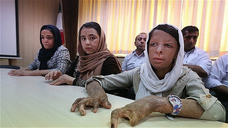 بوي تلخ مهر براي دختران سوخته شين آباد